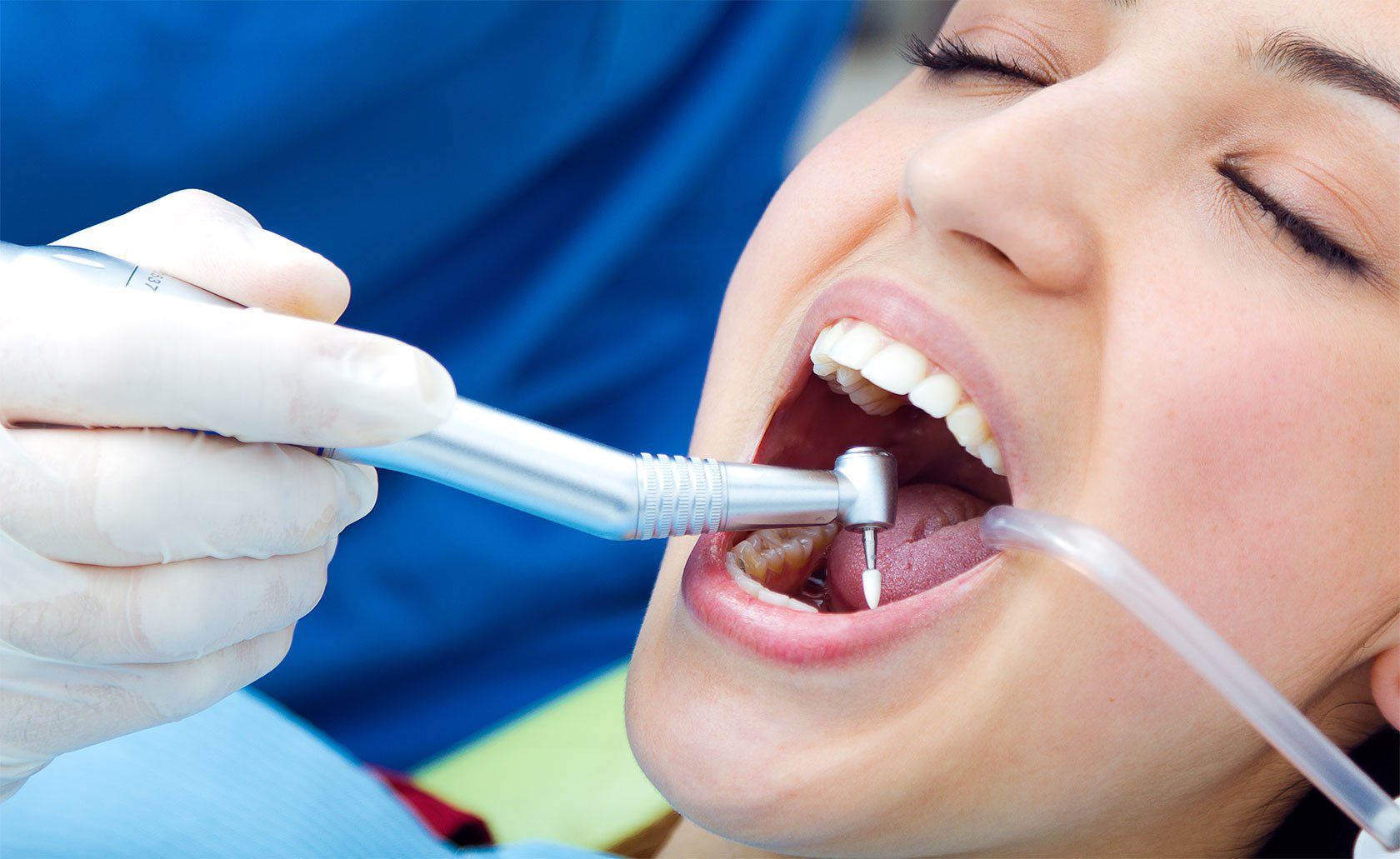 Teeth Scaling and Polishing Get a Healthy Smile at Apex Dental and